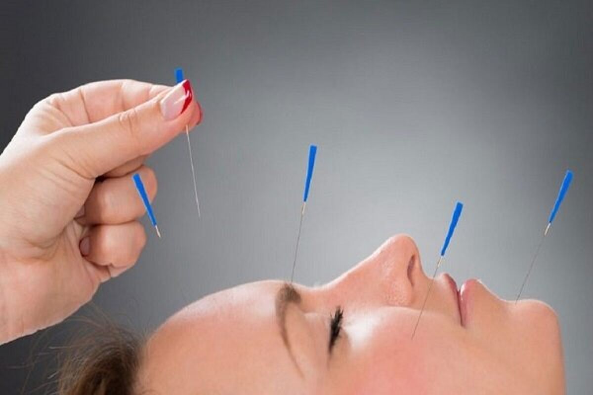 عوارض مهم طب سوزنی