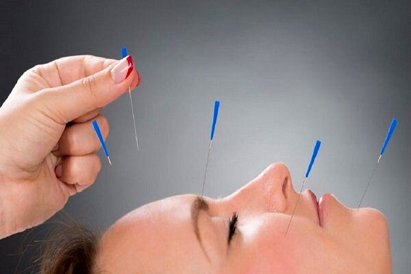 عوارض مهم طب سوزنی