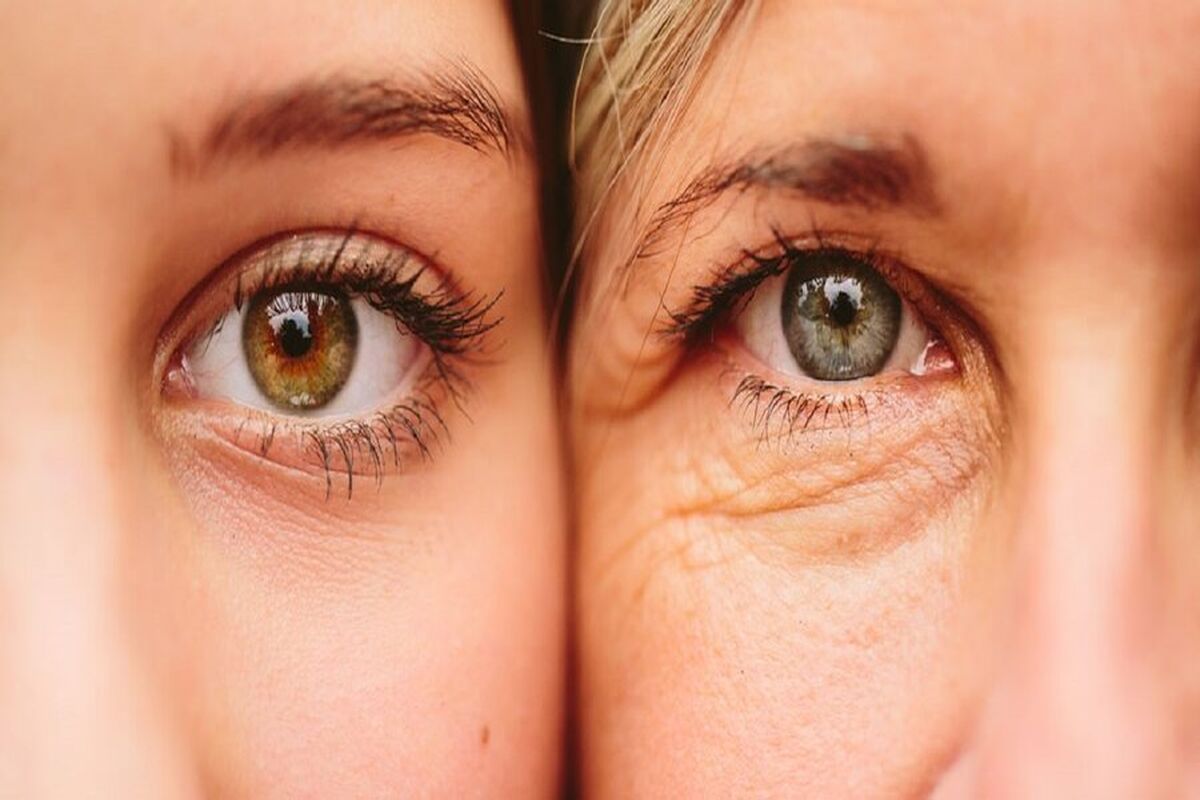 چروک‌های پوست صورت از یک بیماری مرگبار خبر می‌دهند؟