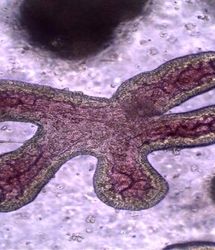 سازمان بهداشت جهانی هشدار داد:با ویروس مرگبار نیپا آشنا شوید