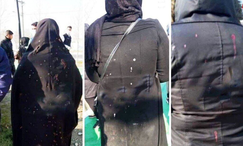 اسیدپاشی هولناک به زنان تهرانی توسط مرد دیوانه/ او چگونه و در کجا به طرف زنان اسید می پاشید؟
