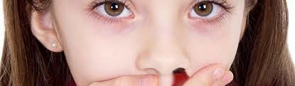 چرا خون دماغ می‌شویم؟