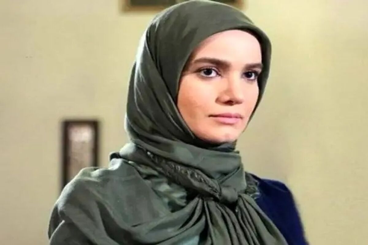 تغییر چهره عجیب و غریب بازیگر جوان با ژل و بوتاکس + ببینید