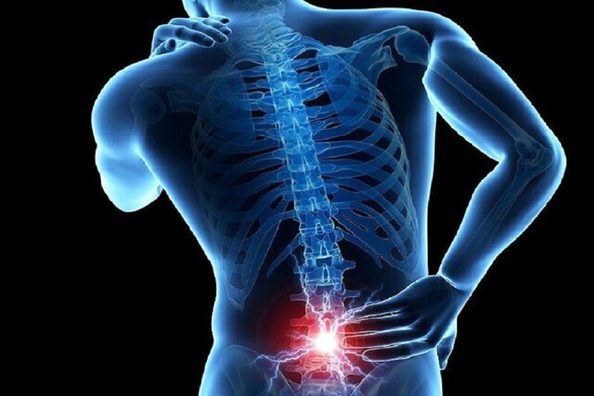 این کمر درد ها قطعا نیاز به جراحی دارند