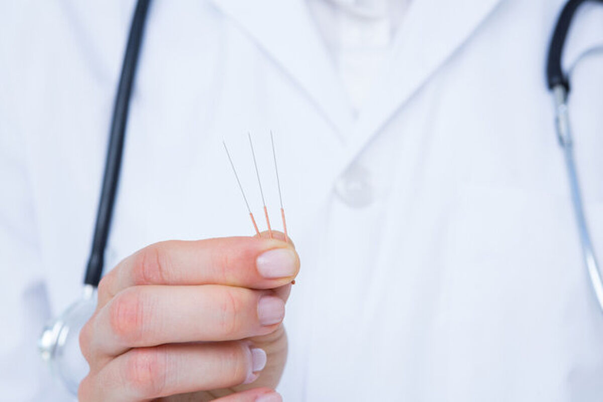 طب سوزنی خطر سکته مغزی را کاهش می‌دهد!