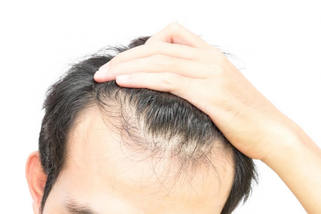 اگر این عادت ها را دارید برای همیشه با موهای خود خداحافظی کنید