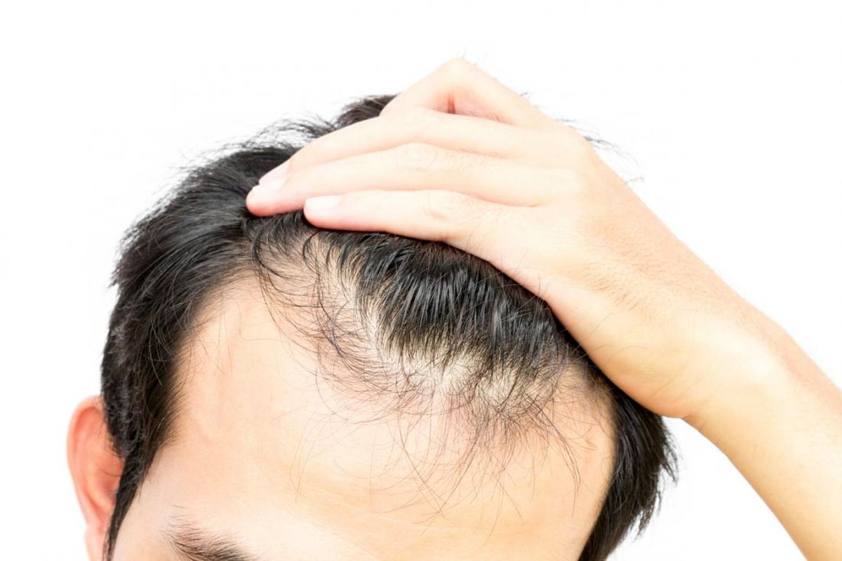 اگر این عادت ها را دارید برای همیشه با موهای خود خداحافظی کنید