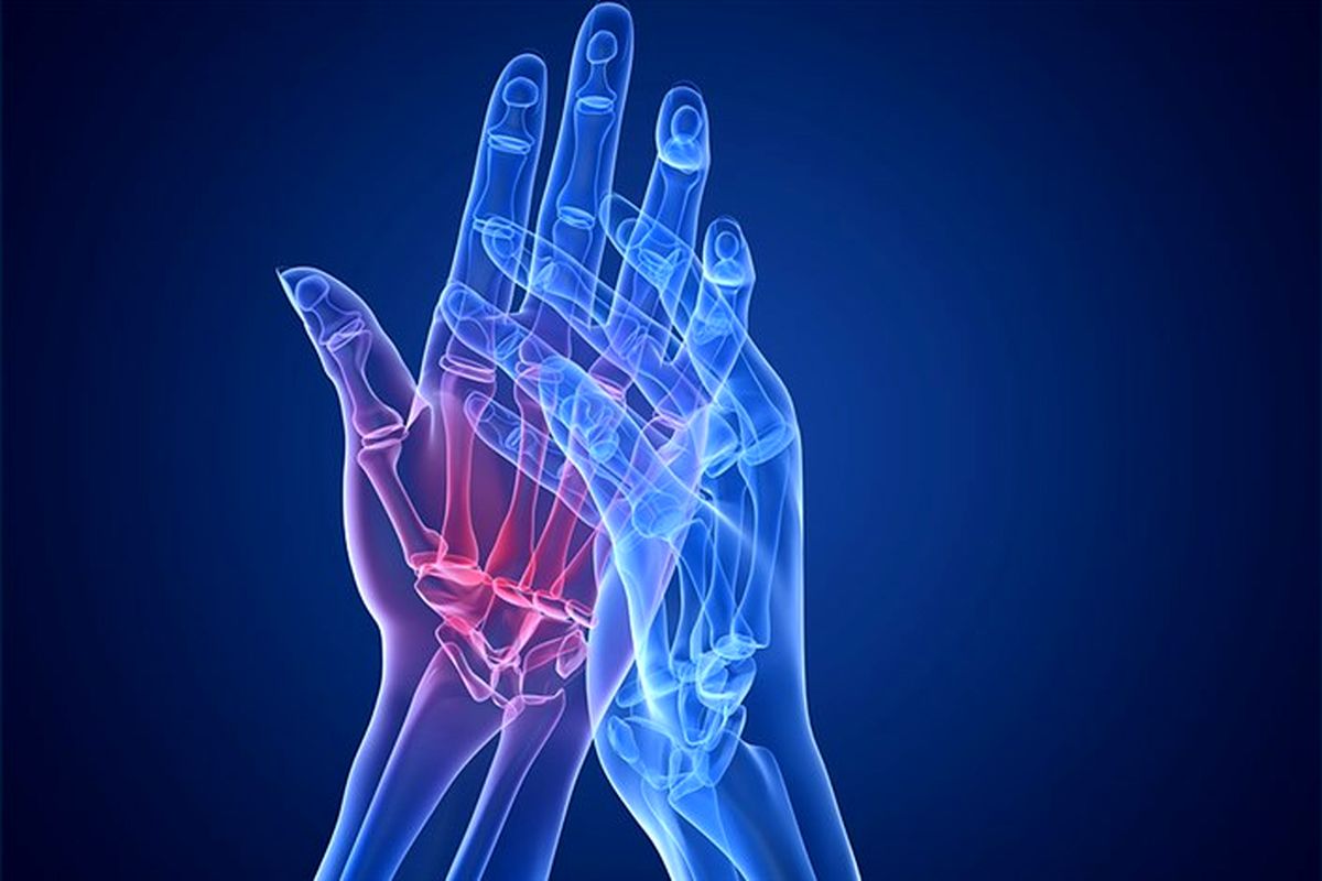 آشنایی با درمان خانگی روماتیسم