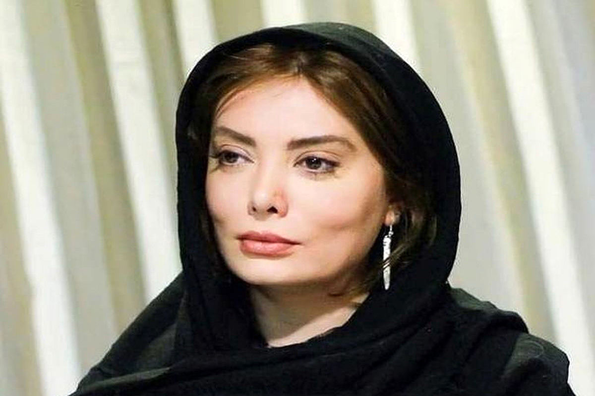خانم بازیگر مشهور تغییر چهره داد+عکس