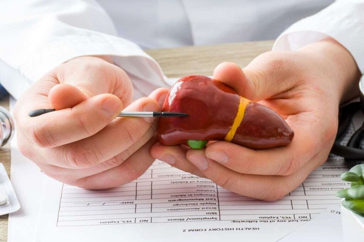 خوراکی‌های مفید برای درمان کبد چرب