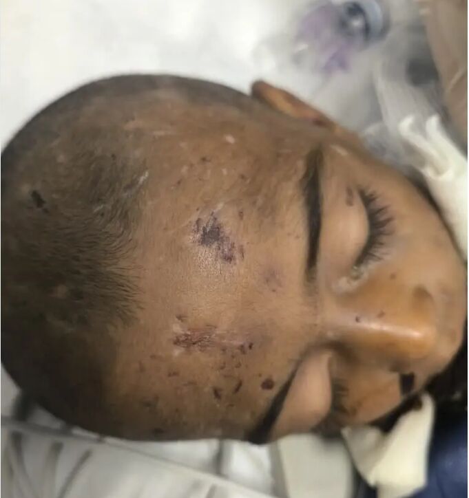 ماجرای مرگ کودک ۴ساله بر اثر کودک آزاری/ خانواده ادعا کرده‌اند؛ کودک از بالای درخت افتاده/عکس‌های +18