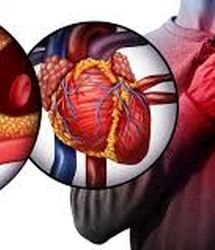 نشانه های روی ناخن که یعنی کلسترول خون شما بالا است