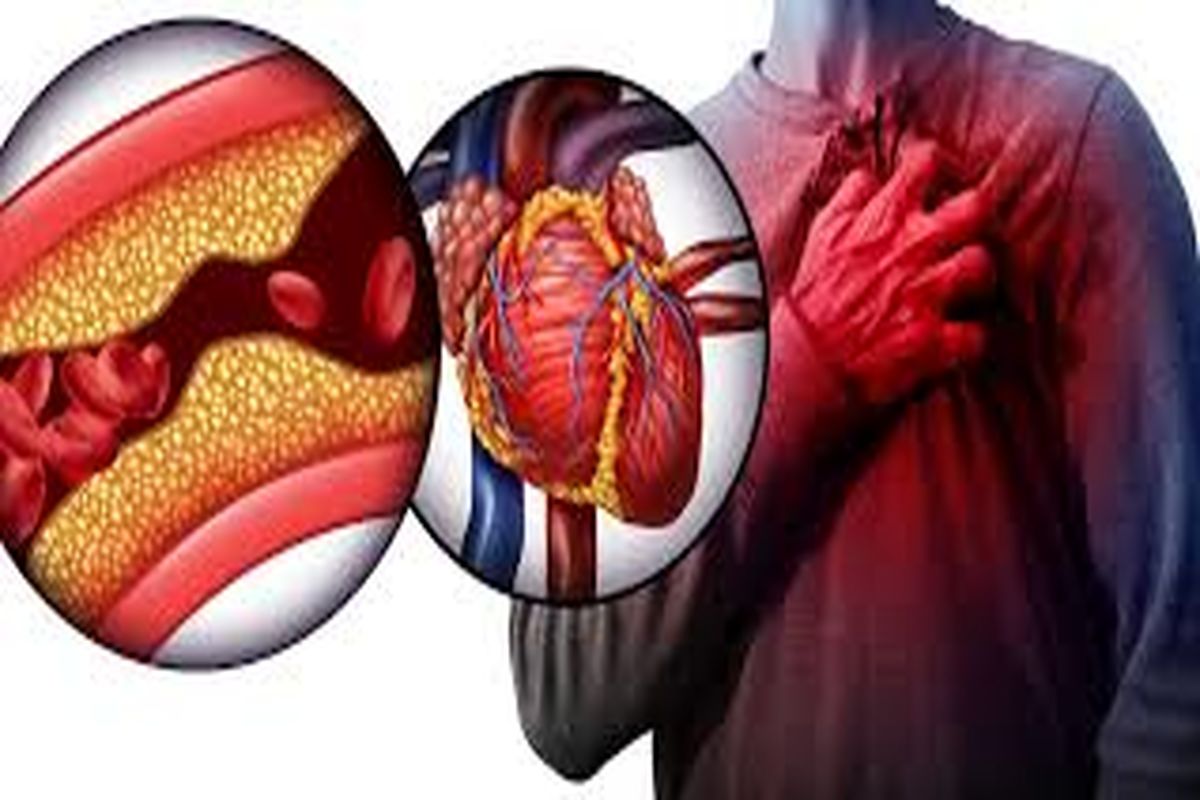 کلسترول را با این 5 سبزی ضربه فنی کنید