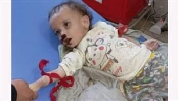 سرنوشت غم انگیز دختر ۲ ساله