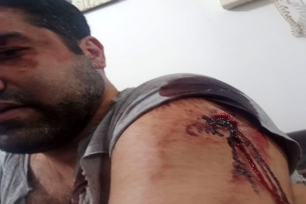 حمله با چاقو به یک استاد دانشگاه در کرج / ماجرا چه بود؟ + عکس