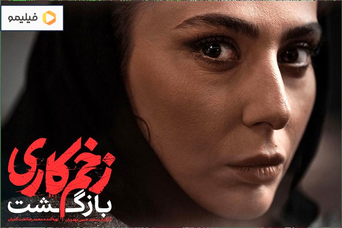 تغییر چهره باورنکردنی و پیرِ سمیرایِ زخم کاری و همسرش