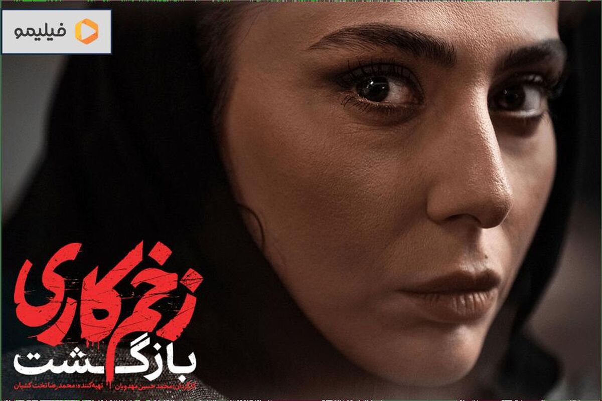 تغییر چهره باورنکردنی و پیرِ سمیرایِ زخم کاری و همسرش