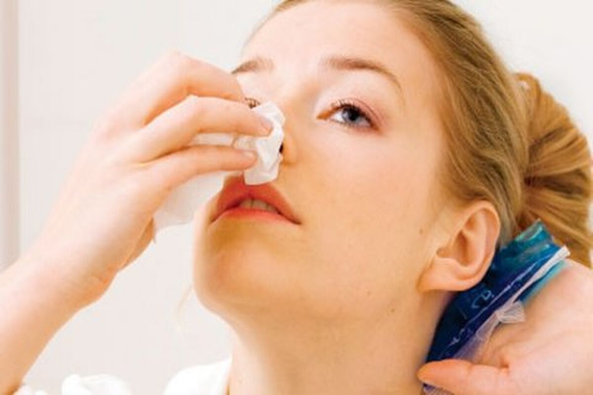 اگر خون دماغ شدیم چه کارهایی انجام بدهیم؟