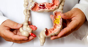 چند راهکار فوق العاده برای افزایش سلامت روده