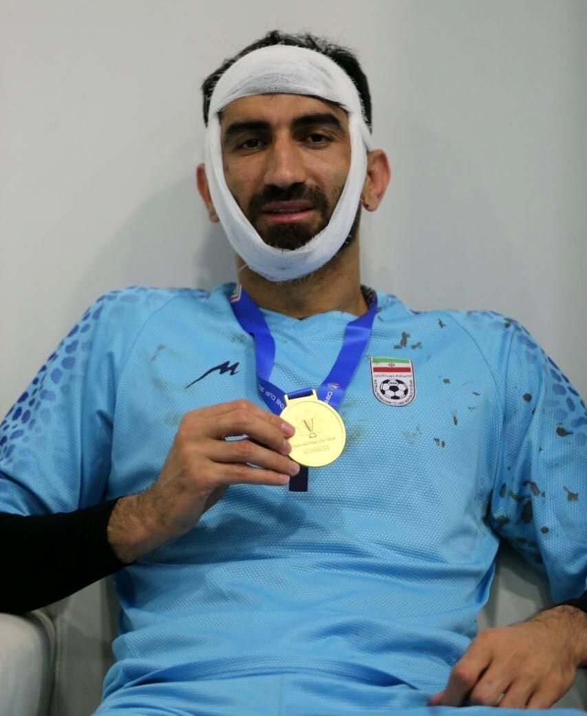 تصاویری هولناک از بیرانوند بعد از دعوای شدید با پرسپولیس!