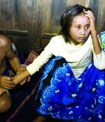 زنی که 18 سال در جنگل مثل میمون روی درخت زندگی کرد! +عکس