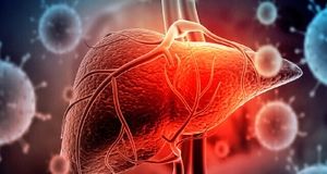 به راحتی از شر کبد چرب خلاص شوید