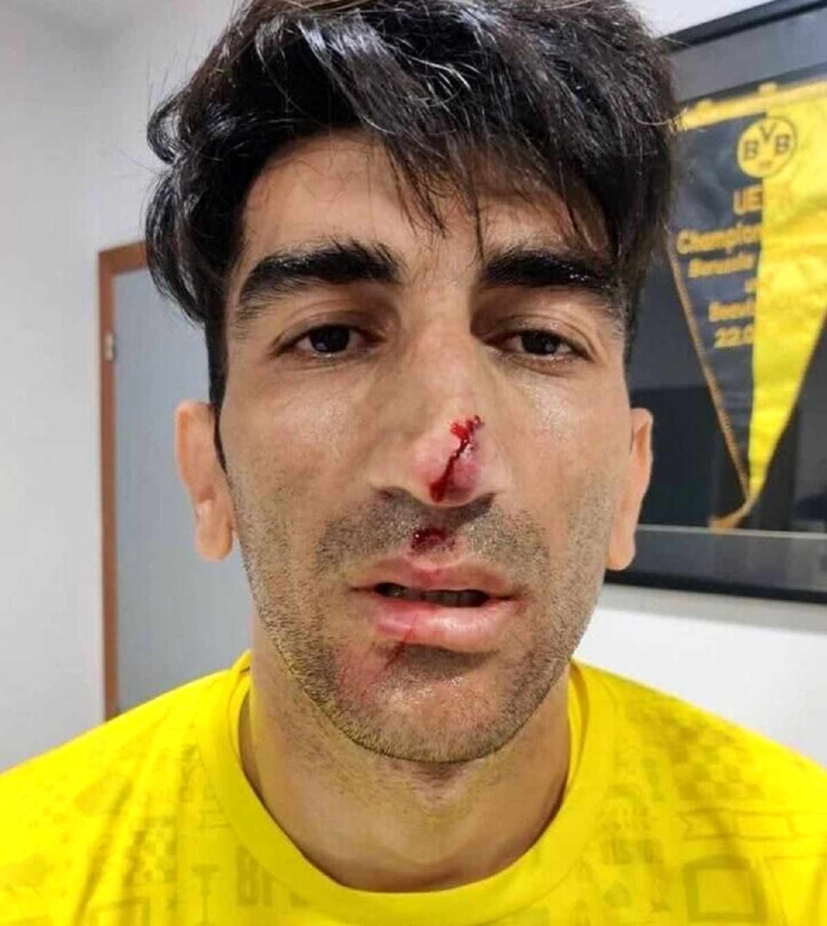 جزییات ماجرای حمله به علیرضا بیرانوند در مسیر بازگشت به تهران