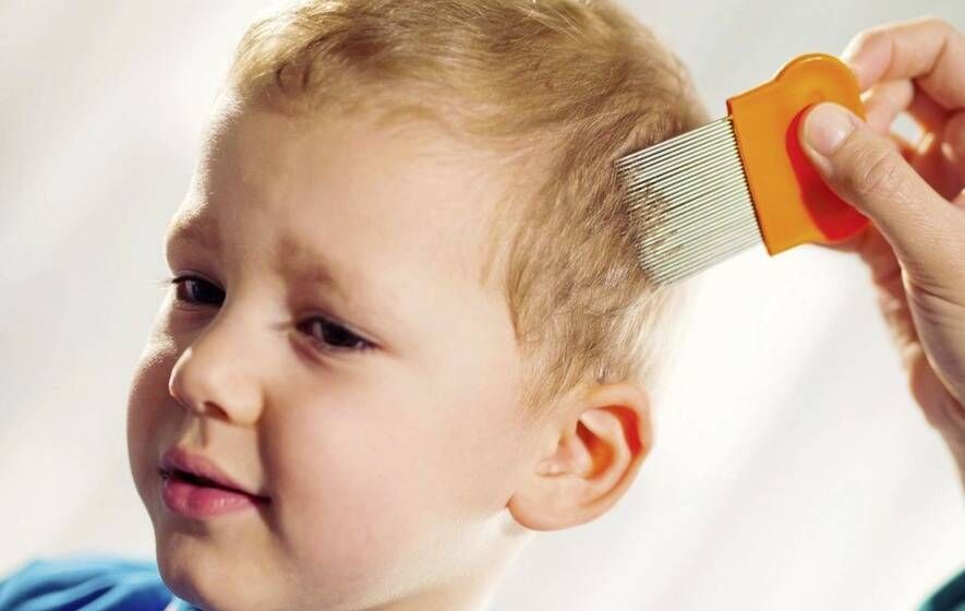 آیا واقعا درمان شپش با سس مایونز ممکن است؟