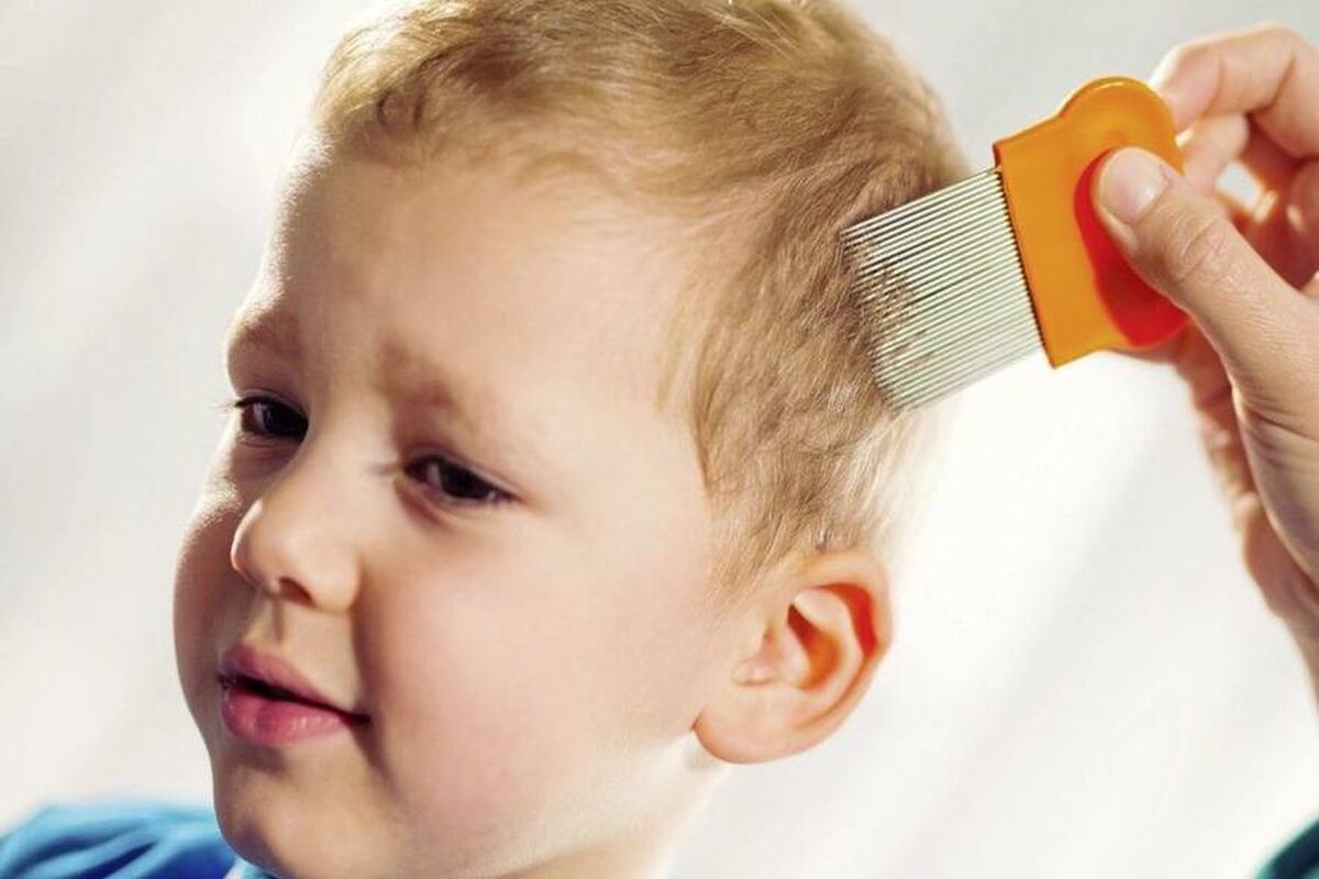 آیا واقعا درمان شپش با سس مایونز ممکن است؟