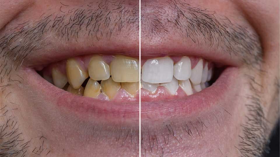 روش ساخت خمیردندان گیاهی 