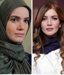 متین ستوده قبل و بعد از تزریقات زیبایی را ببینید/ تصاویر