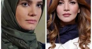 متین ستوده قبل و بعد از تزریقات زیبایی را ببینید/ تصاویر