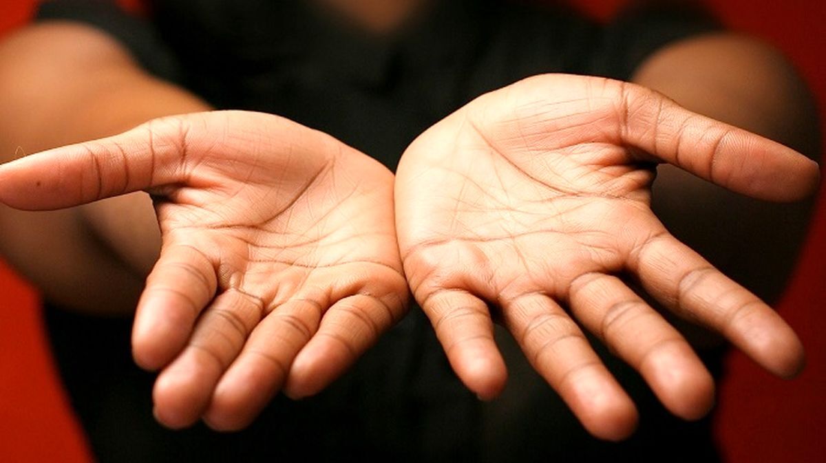 دلیل عرق کردن کف دست