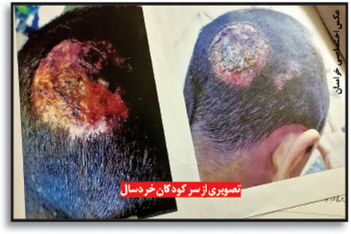 کودکآزاری مردی که گوشت الاغ میفروخت فاش شد