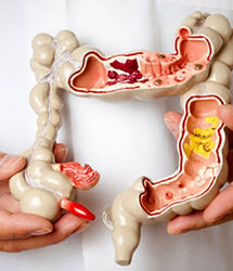 ۵ دلیل مهم یبوست که خیلی‌ها نمی‌دانند