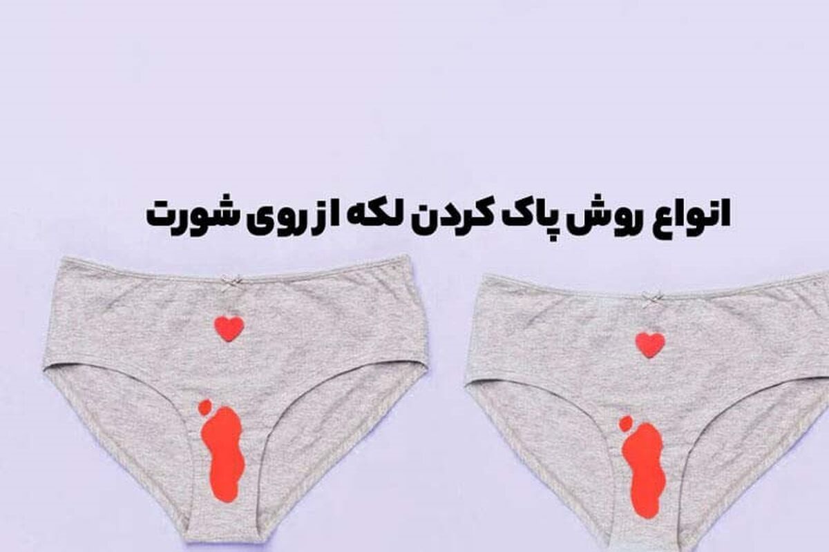 انواع روش پاک کردن لکه از روی شورت
